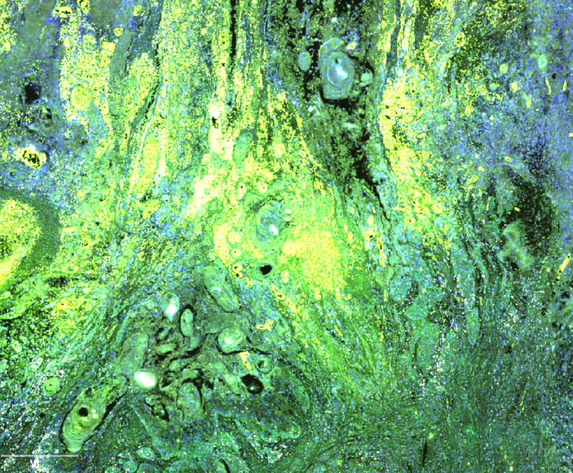 Multiplex Imaging Analysis